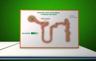 Introduction to SGLT2 Inhibition